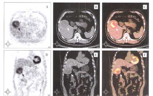 petct-2012-07-23-lqz-01.jpg