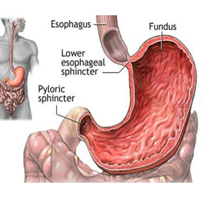 胃癌是怎么形成的图片