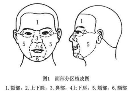面部医学区域划分图片