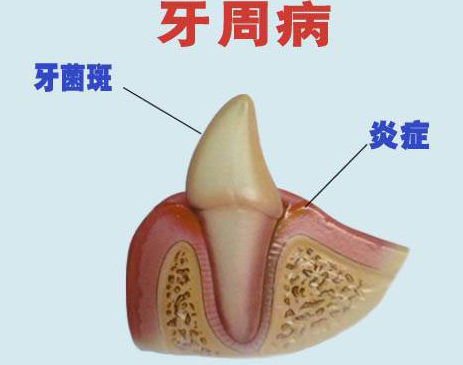 牙周的位置图片图片