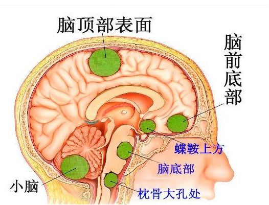 脑膜结构解剖图图片