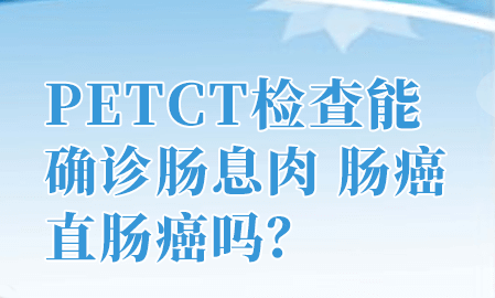 开云体育下载平台官网检查肠道癌症准确率有多高？