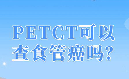petct可以检查消化道的肿瘤吗？