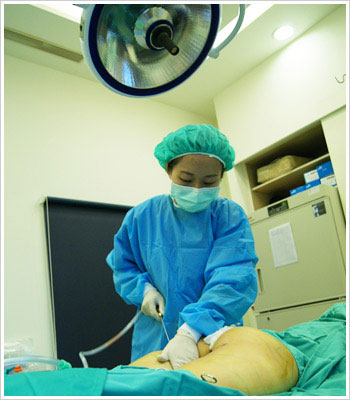 隆胸手术过程 实拍图片
